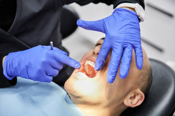 Best Broken Tooth Emergency  in Walnut Grove, CA